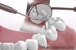 メインテナンス