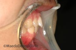 スリープスプリント